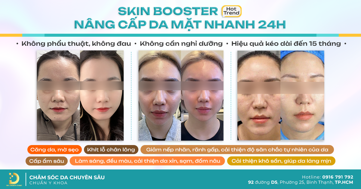 Top 3 cơ sở trẻ hóa căng da mặt uy tín tại TPHCM