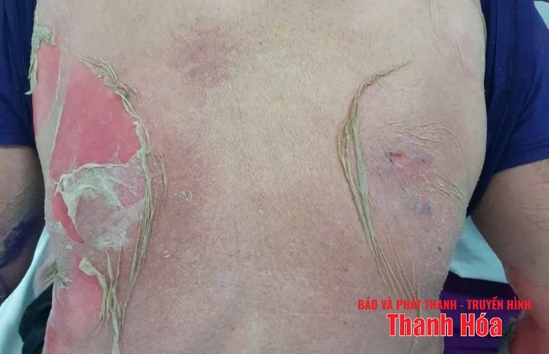 Hàng giả “bủa vây”, ai bảo vệ người tiêu dùng? (Bài 2): Ma trận từ không gian mạng đến đời sống thường ngày