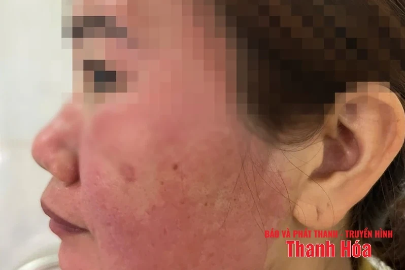 Hàng giả “bủa vây”, ai bảo vệ người tiêu dùng? (Bài 1): Khi người bệnh đặt nhầm niềm tin vào thuốc giả