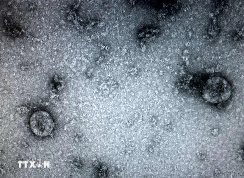 Phát hiện sự liên quan giữa COVID-19 và hoại tử xương