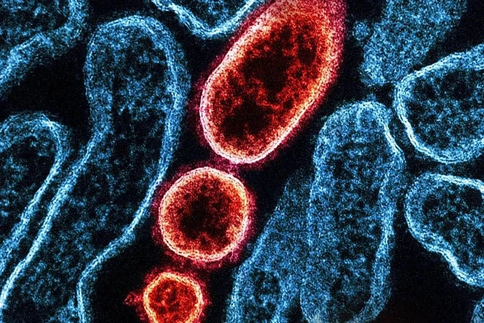 Ấn Độ bác bỏ thông tin về dịch virus Nipah bùng phát diện rộng, Thái Lan tăng cường giám sát