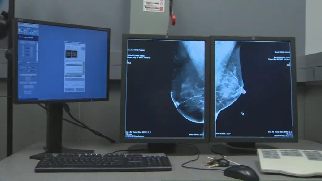 Số ca mắc ung thư vú toàn cầu có thể chạm mốc 3,5 triệu vào năm 2050