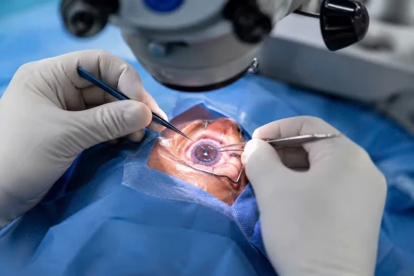 Hàng trăm ngàn người khiếm thị ở Việt Nam có cơ hội tìm lại ánh sáng