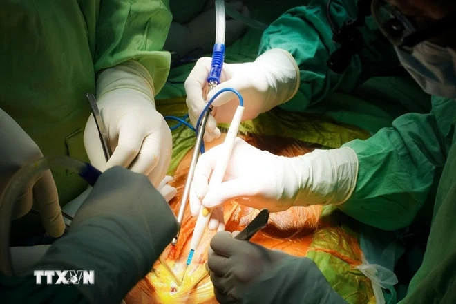 TP Hồ Chí Minh: 6 bệnh nhân được cứu sống nhờ ghép tạng