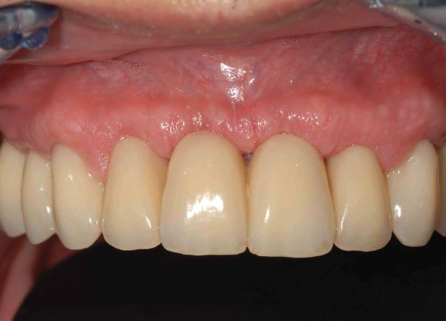 Hành trình tìm lại nụ cười của những người từng mất niềm tin vào nha khoa