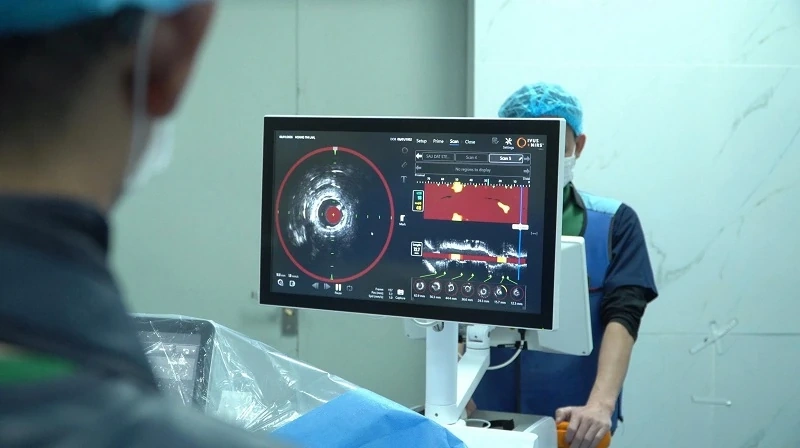 Ca bệnh mạch vành phức tạp đầu tiên tại Thanh Hóa được can thiệp dưới sự hỗ trợ của hệ thống IVUS + NIRS
