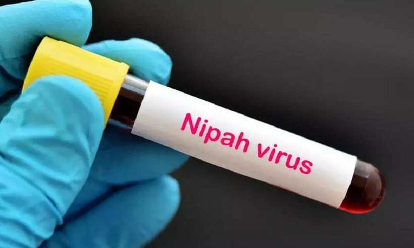 Bộ Y tế hướng dẫn chẩn đoán và điều trị bệnh do virus Nipah