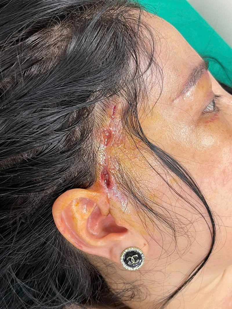 Trào lưu làm đẹp và những hệ lụy đối với sức khỏe