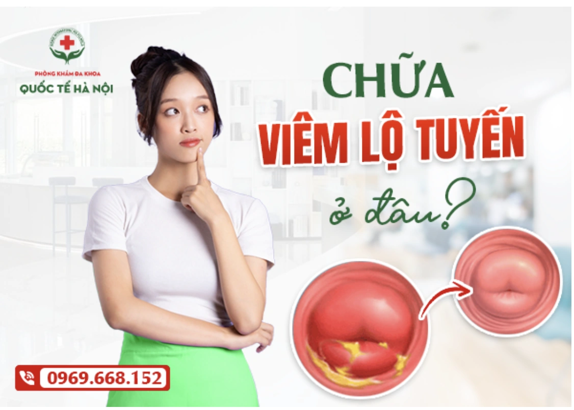Chữa viêm lộ tuyến ở đâu? Gợi ý địa chỉ nhiều chị em thăm khám