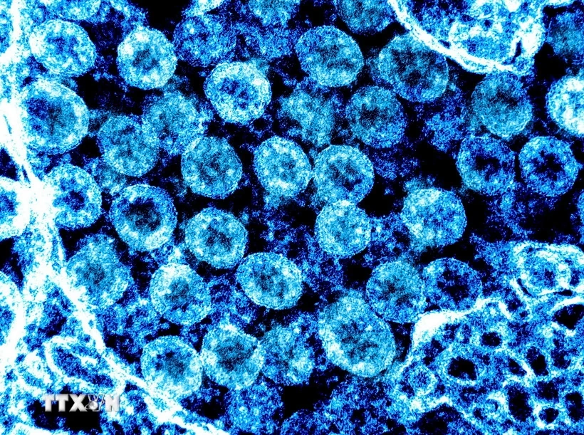 Giới chuyên gia nhận định mức độ nguy hiểm của biến thể mới virus SARS-CoV-2