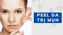 Cơ sở peel da trị mụn hiệu quả tại Thảo Ami Spa