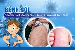 Triển khai chiến dịch tiêm chủng vaccine phòng, chống dịch Sởi năm 2025 đợt 2