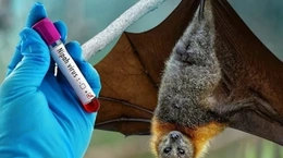 Ngành Y tế Thanh Hóa khuyến cáo về dịch bệnh nguy hiểm do virus Nipah