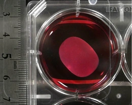 Chuyên gia lo ngại về thuốc tế bào gốc đột phá của Nhật Bản