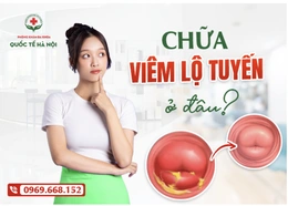Chữa viêm lộ tuyến ở đâu? Gợi ý địa chỉ nhiều chị em thăm khám