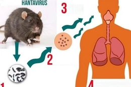 Bộ Y tế khuyến cáo về virus Hanta sau chùm ca tử vong ở tàu du lịch nước ngoài