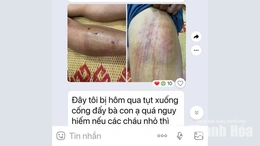 Hố ga, miệng cống mất nắp: “Cái bẫy” giữa đường ngập