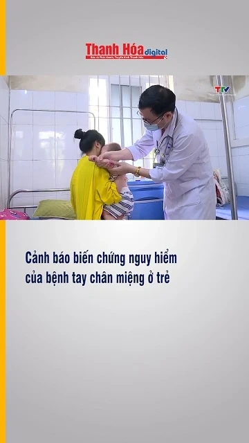 Cảnh báo biến chứng nguy hiểm của bệnh tay chân miệng ở trẻ