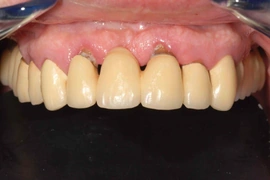 Hành trình tìm lại nụ cười của những người từng “mất niềm tin” vào nha khoa