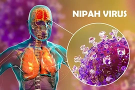 Chưa có thuốc điều trị đặc hiệu,&nbsp;virus Nipah nguy hiểm như thế nào?