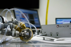 Phổi nhân tạo: Duy trì sự sống với 2 lá phổi được tháo bỏ hoàn toàn