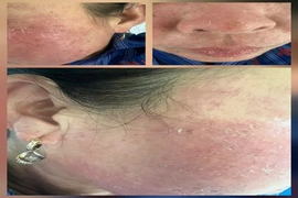 Trào lưu làm đẹp và những hệ lụy đối với sức khỏe