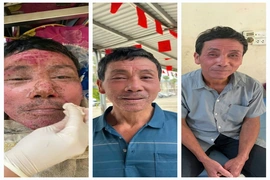 Thực phẩm chức năng: Nguy cơ bị “thổi phồng” công dụng