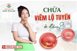 Chữa viêm lộ tuyến ở đâu? Gợi ý địa chỉ nhiều chị em thăm khám