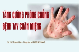 Tăng cường giám sát, xử lý triệt để ổ dịch&nbsp;