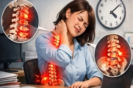 Thói quen cúi đầu kéo dài và những hệ lụy