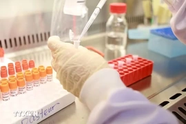 Bộ Y tế đề xuất 441 xét nghiệm, điện quang có thể dùng lại khi chuyển viện