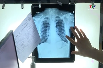 Một làn khói nhiều hệ lụy