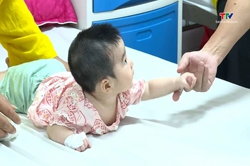 Phẫu thuật khe hở môi – Thắp sáng nụ cười trẻ thơ