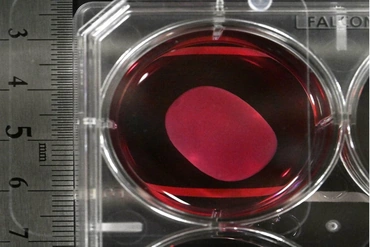 Chuyên gia lo ngại về thuốc tế bào gốc đột phá của Nhật Bản