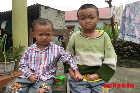 Xót xa hai anh em mắc bệnh hiểm nghèo