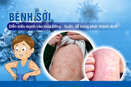 Triển khai chiến dịch tiêm chủng vaccine phòng, chống dịch Sởi năm 2025 đợt 2