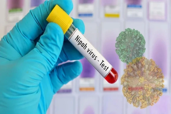 Ấn Độ bác bỏ thông tin về dịch virus Nipah bùng phát diện rộng, Thái Lan tăng cường giám sát