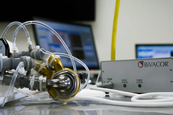 Phổi nhân tạo: Duy trì sự sống với 2 lá phổi được tháo bỏ hoàn toàn