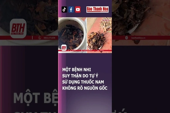 Dùng thuốc nam không rõ nguồn gốc: Một bệnh nhi suy thận | Báo Thanh Hóa