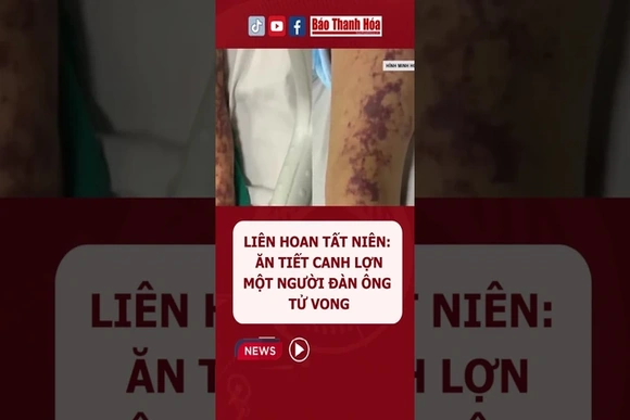 Ăn tiết canh lợn, một người đàn ông t.ử v.o.n.g | Báo Thanh Hóa