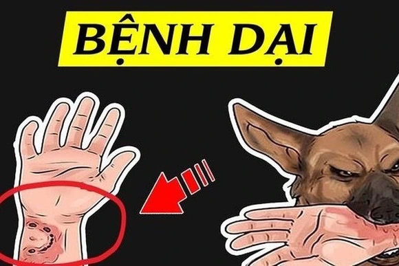 Công điện về việc tập trung thực hiện nghiêm công tác phòng, chống bệnh Dại