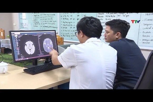 Đột quỵ gia tăng ở người trẻ tuổi