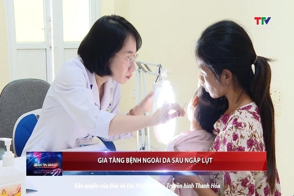 Gia tăng bệnh ngoài da sau ngập lụt
