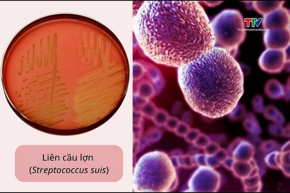 Thay đổi thói quen ăn uống để phòng liên cầu lợn