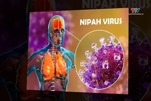 Ban hành hướng dẫn chẩn đoán, điều trị bệnh do virus Nipah