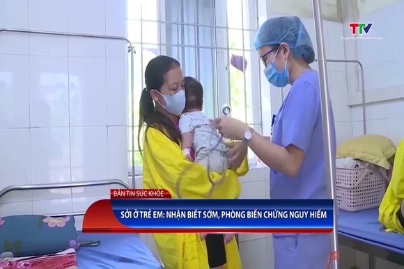Sởi ở trẻ em: Nhận biết sớm, phòng biến chứng nguy hiểm