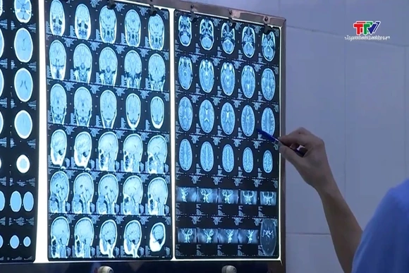 Thanh Hoá tăng cường phòng, chống bệnh viêm não Nhật Bản