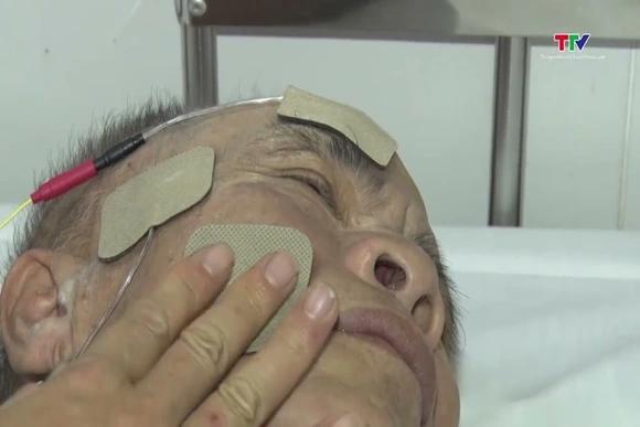 Cảnh báo liệt dây thần kinh số 7 do sốc nhiệt vào mùa hè